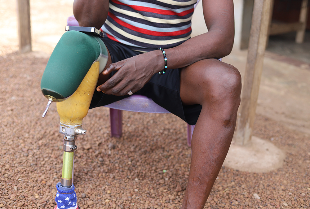 Mohamed Santigie Bangura, 45, shows off the scars of the injuries he sustained during the 1991-2002 civil war in Sierra Leone. Since the end of the civil war, religious sisters have been helping survivors and perpetrators deal with trauma and bringing them together to forgive each other and reconcile. (GSR photo/Doreen Ajiambo)