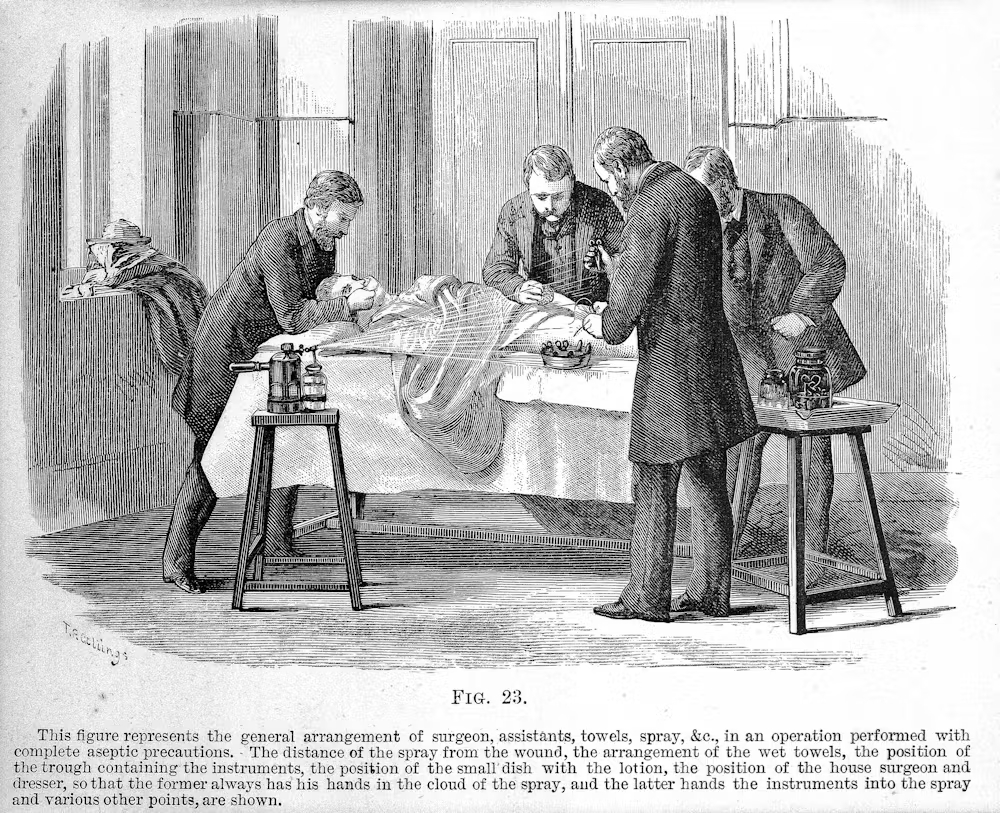 Antique illustration portraying surgery. 